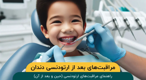 مراقبت-های-بعد-از-ارتودنسی-دندان